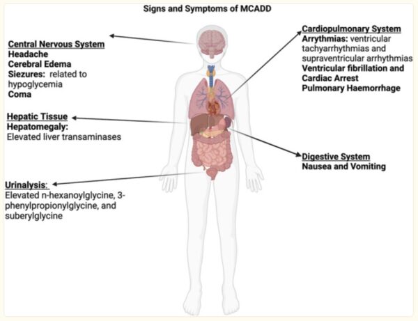 Medium Chain Acyl-CoA Dehydrogenase Deficiency: Check your genetic data