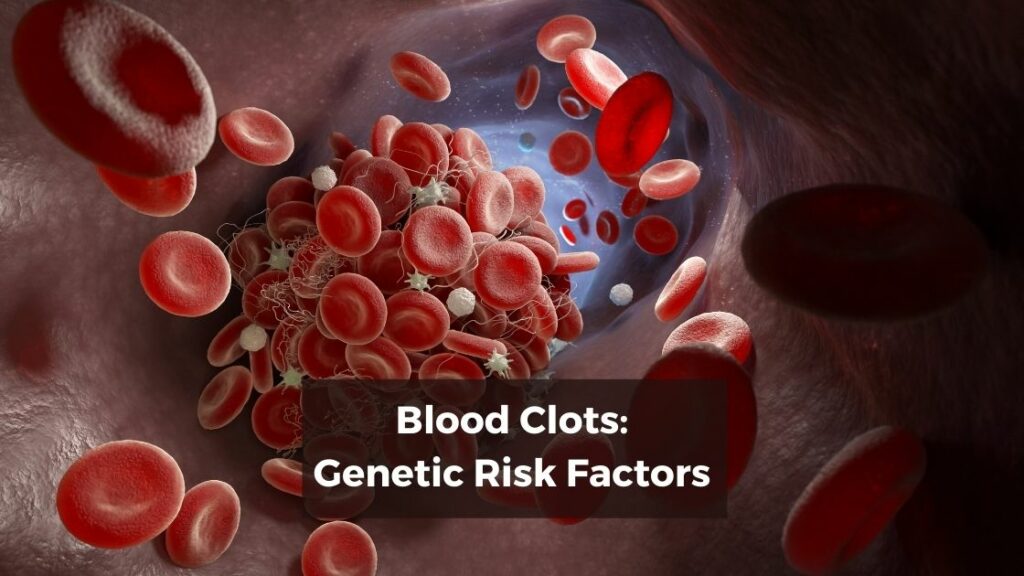 7 genetic variants that increase your risk of blood clots - Genetic ...