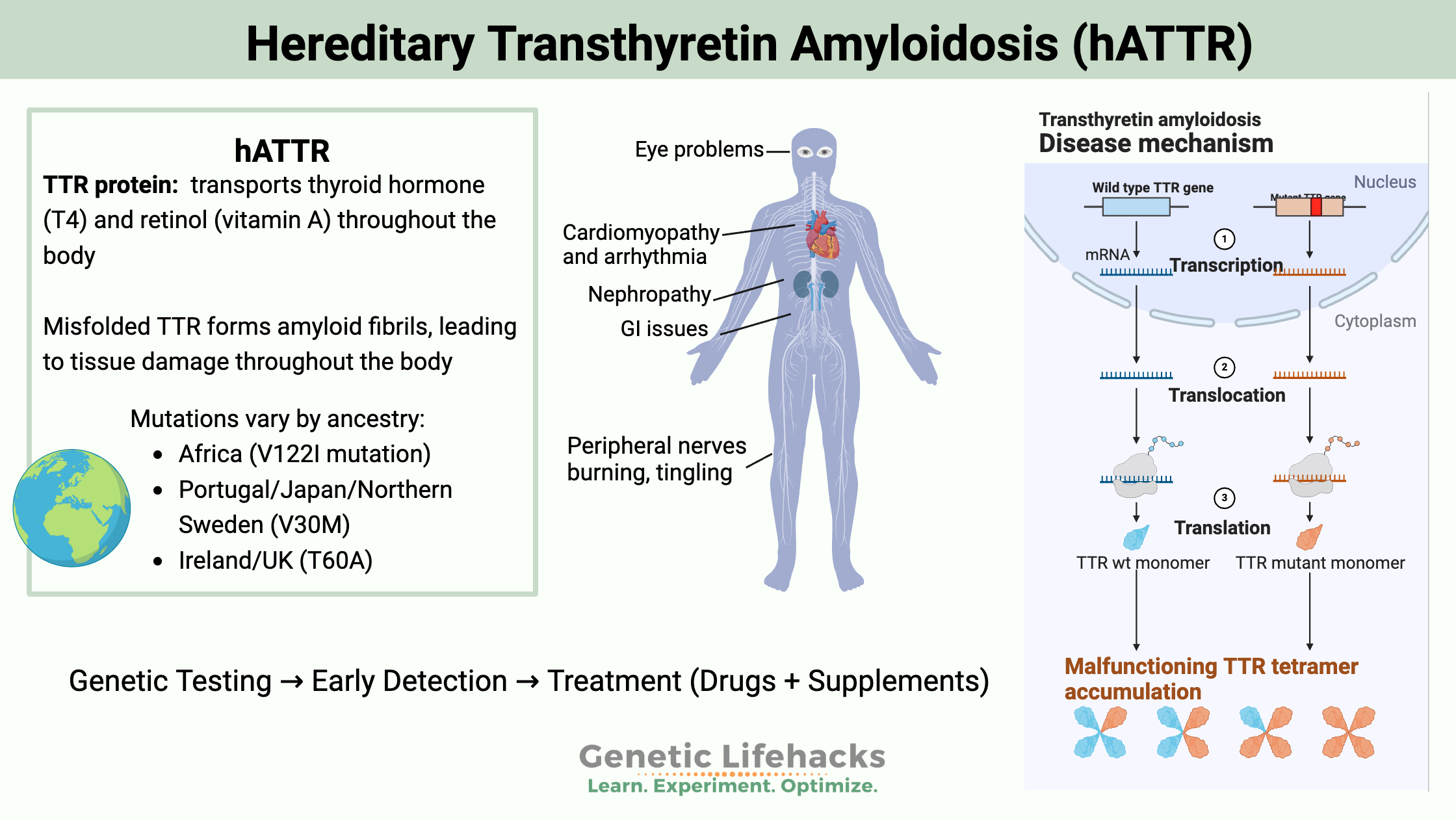 Hereditary Transthyretin Amyloidosis hATTR