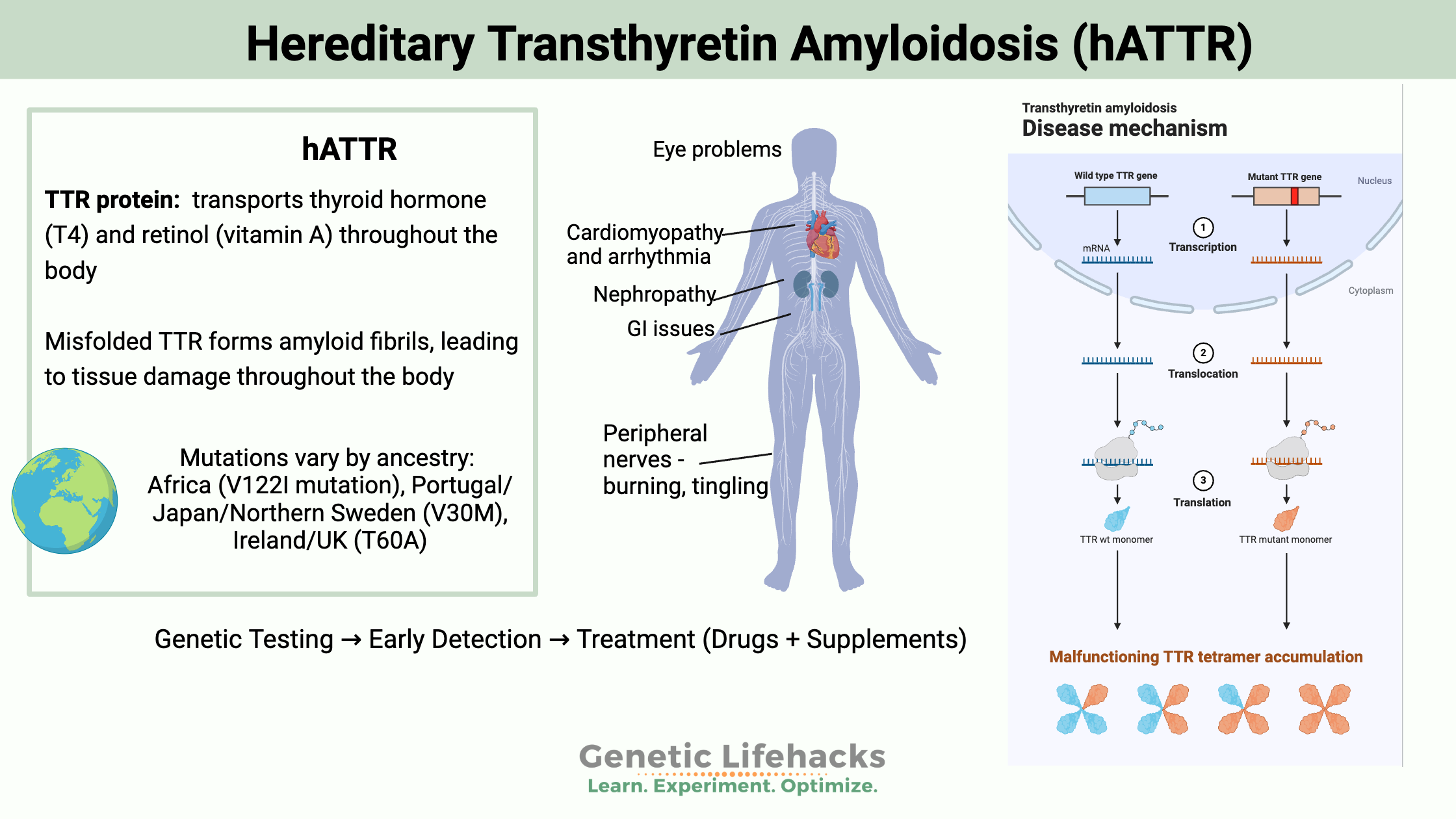 Hereditary Transthyretin Amyloidosis hATTR