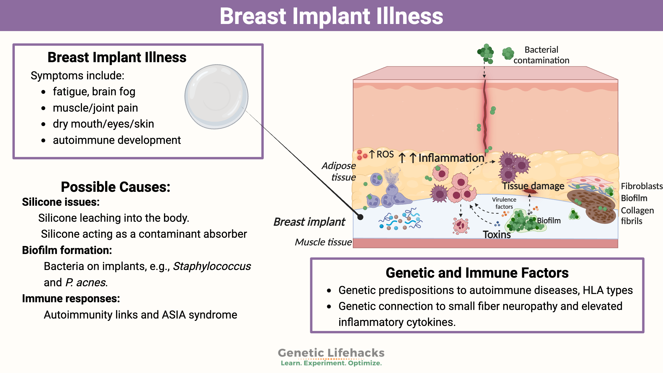 Breast Implant Illness, genetic influence, causes