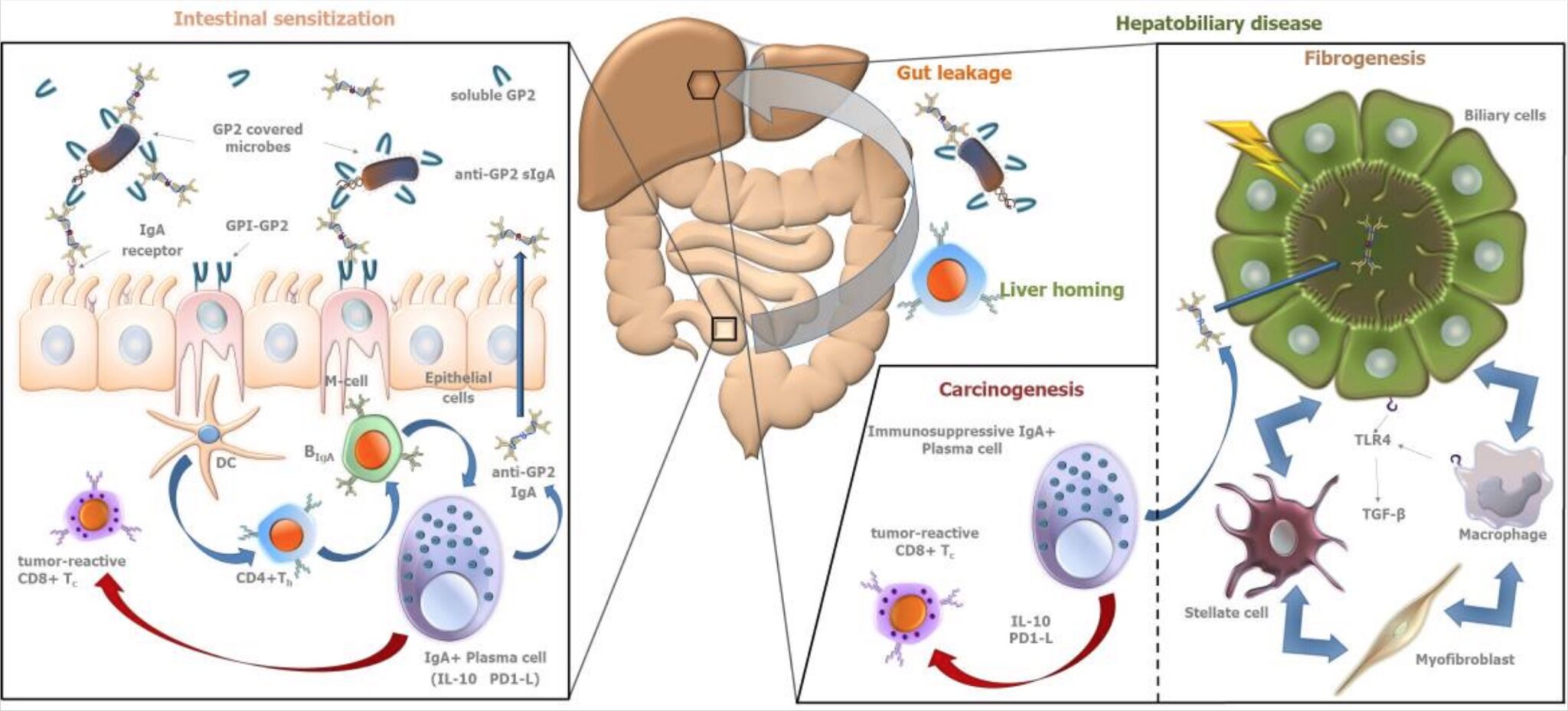 Primary Sclerosing Cholangitis