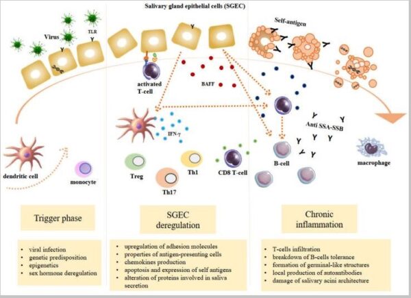 Sjogren's Syndrome: Causes, Genes, Solutions