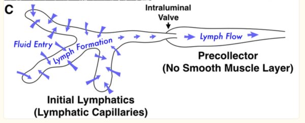 Lymphedema: Causes and Genetic Pathways