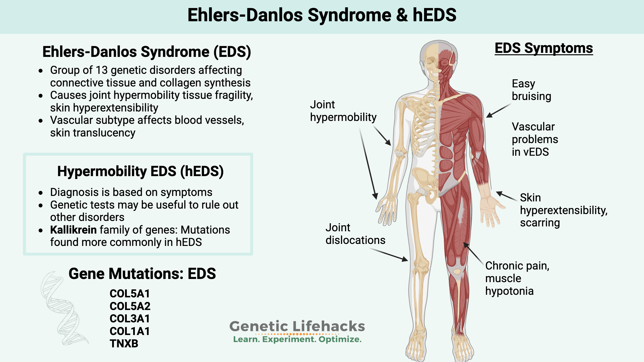 Ehlers-Danlos Syncrome, symptoms, genetics of hEDS