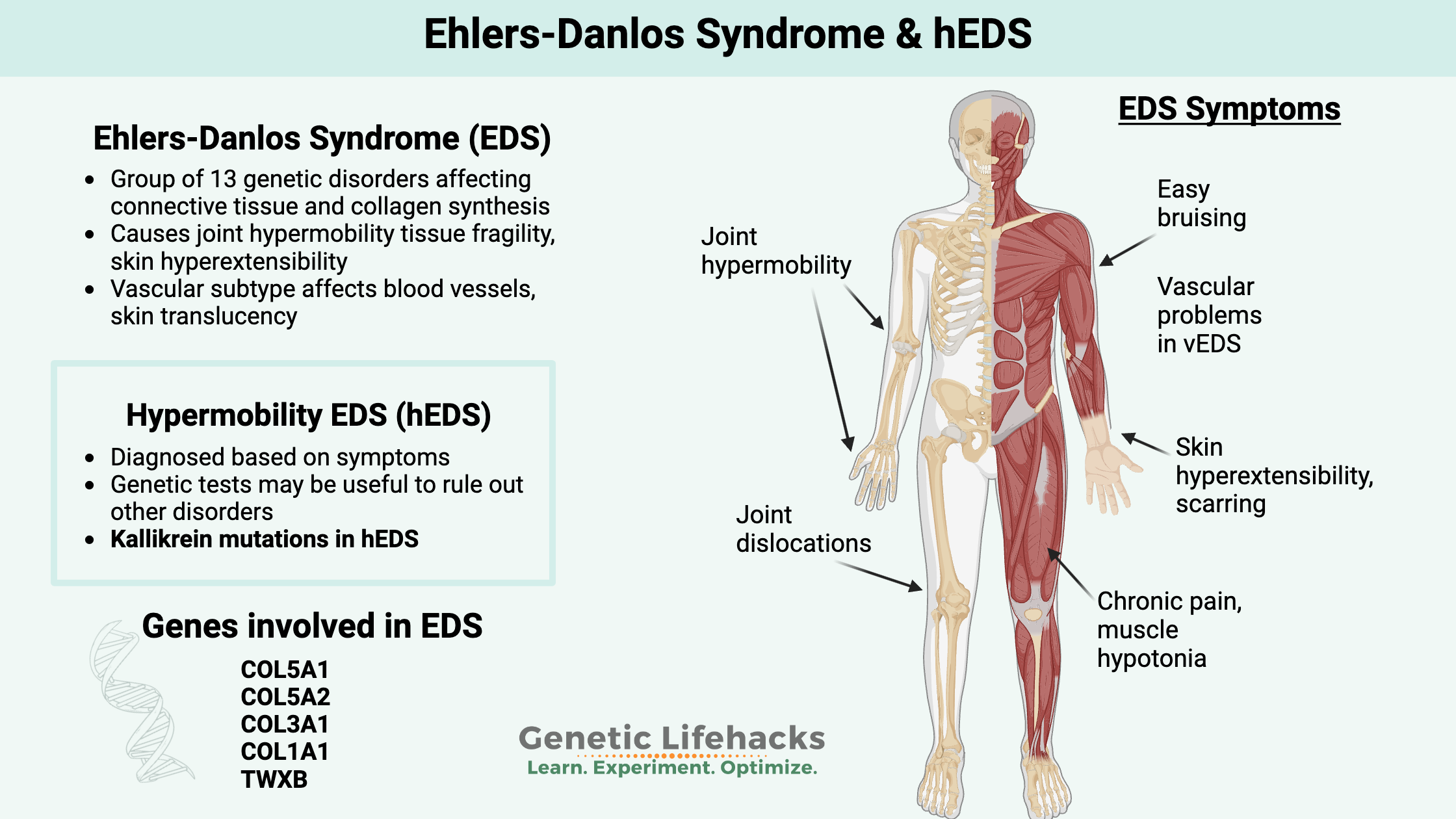 Ehlers-Danlos Syncrome, symptoms, genetics of hEDS
